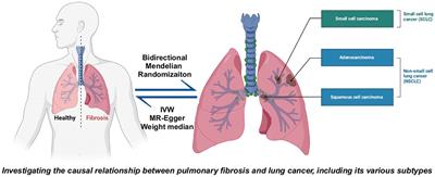 Fibrosis to carcinogenesis: unveiling the causal dynamics between pulmonary fibrosis and lung cancer